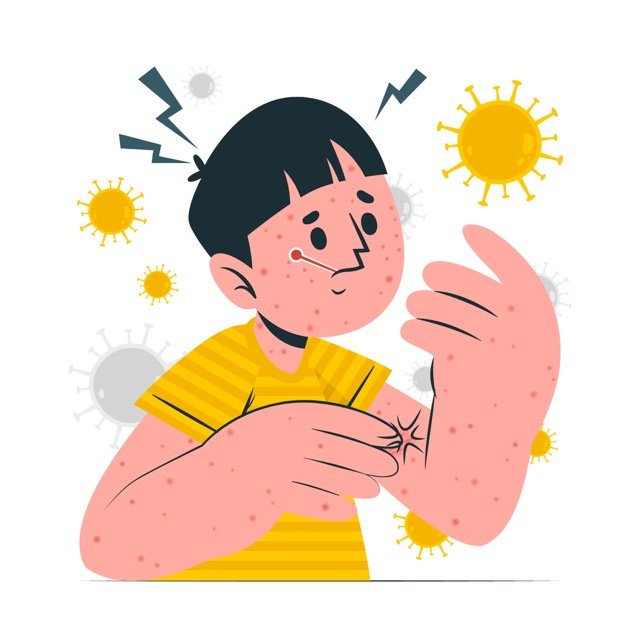 chicken pox cure by dr Shivraj hospital