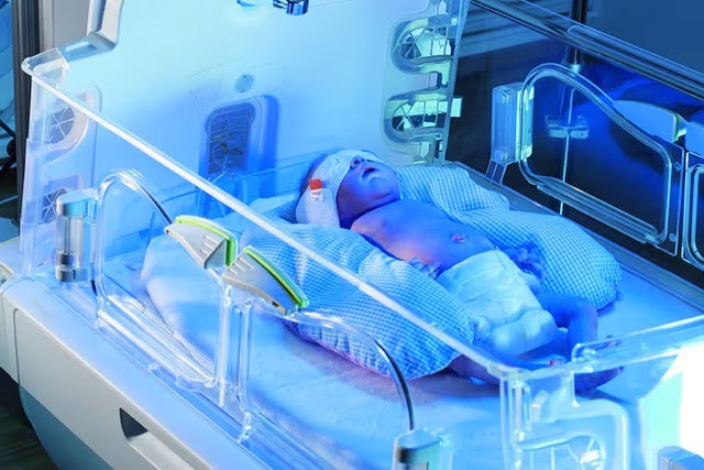 Phototherapy treatment of child for jaundice by dr Shivraj hospital fathepur sikar