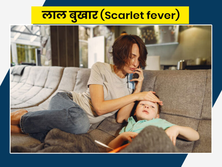 स्कारलेट फीवर (लाल बुख़ार):- कारण, लक्षण और बचाव लाल बुख़ार